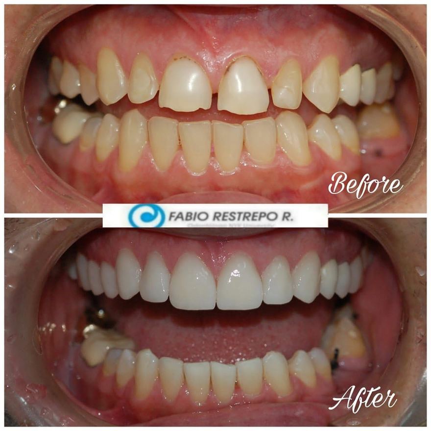 Antes y después — caso 1